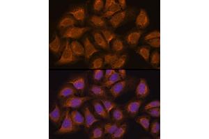 Immunofluorescence analysis of U2OS cells using USP5 antibody (ABIN1683231, ABIN3018687, ABIN3018688 and ABIN6220542) at dilution of 1:100.