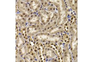 Immunohistochemistry of paraffin-embedded mouse kidney using HIRIP3 antibody at dilution of 1:100 (x400 lens). (HIRIP3 anticorps)