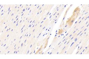 anti-Peripheral-Type Benzodiazepine Receptor (TSPO) (AA 1-169) antibody