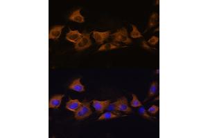 Immunofluorescence analysis of C6 cells using B2 Rabbit pAb (ABIN6127467, ABIN6137310, ABIN6137311 and ABIN6225253) at dilution of 1:100.