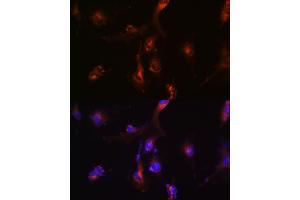 Immunofluorescence analysis of U-251 MG cells using NFS1 Rabbit pAb (ABIN6130225, ABIN6144595, ABIN6144597 and ABIN6222373) at dilution of 1:100 (40x lens).