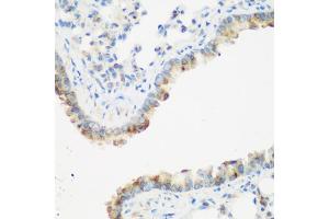 Immunohistochemistry of paraffin-embedded mouse lung using IGF2BP3 antibody (ABIN5972501) at dilution of 1/200 (40x lens). (IGF2BP3 anticorps)