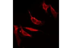 ABIN6275595 staining HepG2 by IF/ICC.