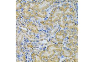 Immunohistochemistry of paraffin-embedded mouse kidney using PGK1 Antibody.