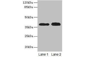 Western blot All lanes: CTSL antibody at 12 μg/mL Lane 1: A549 whole cell lysate Lane 2: HepG2 whole cell lysate Secondary Goat polyclonal to rabbit IgG at 1/10000 dilution Predicted band size: 38 kDa Observed band size: 38 kDa (Cathepsin L anticorps  (AA 114-333))
