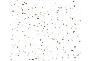 Immunocytochemistry (ICC) image for anti-Topo IIalpha (AA 650-700) antibody (ABIN7795794) (Recombinant Topo IIalpha (AA 650-700) anticorps)