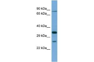 Host:  Rabbit  Target Name:  SLC6A9  Sample Type:  THP-1 Whole cell lysates  Antibody Dilution:  1. (GLYT1 anticorps  (N-Term))