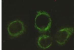 Immunocytochemistry stain of Hela using Pyruvate Dehydrogenase E2 mouse mAb (1:300). (CYB561 anticorps)