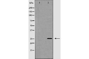 Western blot analysis of NGF beta expression in Jurkat cells,The lane on the left is treated with the antigen-specific peptide. (Nerve Growth Factor anticorps  (Internal Region))