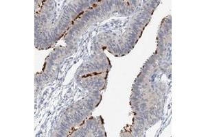 Immunohistochemical staining of human fallopian tube with DNAH5 polyclonal antibody  shows distinct positivity in the cilia at 1:10-1:20 dilution. (Dnah5 anticorps)