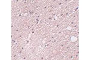 Immunohistochemistry of FRMPD4 in human brain tissue with FRMPD4 antibody at 5 μg/ml.