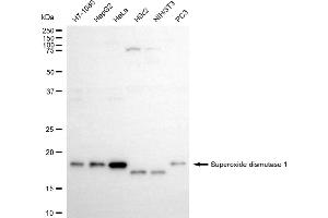 Western blotting analysis using superoxide dismutase 1 antibody (ABIN7800461). (Recombinant SOD1 anticorps)