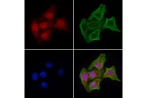 ABIN6263956 and ABIN6268907 staining HepG2 cells by IF/ICC. (p300 anticorps  (N-Term))