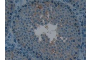 anti-Lymphotoxin beta Receptor (TNFR Superfamily, Member 3) (LTBR) (AA 128-395) antibody