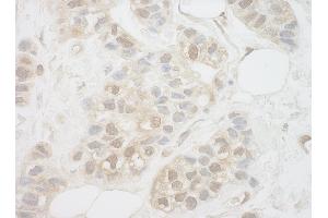 Immunohistochemistry (IHC) image for anti-Uridine-Cytidine Kinase 1-Like 1 (UCKL1) (AA 1-50) antibody (ABIN7454848)