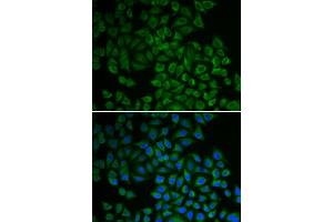 Immunofluorescence analysis of HeLa cell using SGK1 antibody. (SGK1 anticorps)