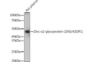 Western blot analysis of extracts of Rat plasma, using Zinc-α2-glycoprotein (ZAG/) Rabbit mAb (ABIN7265556) at 1:1000 dilution. (AZGP1 anticorps)