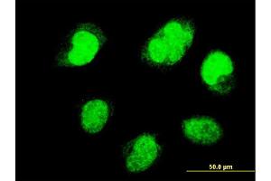 Immunofluorescence of monoclonal antibody to PAX7 on HeLa cell. (PAX7 anticorps  (AA 411-520))