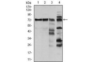 Western Blotting (WB) image for anti-V-Raf-1 Murine Leukemia Viral Oncogene Homolog 1 (RAF1) antibody (ABIN1108823)