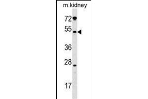 GALNT13 Antibody (Center) (ABIN1539681 and ABIN2849709) western blot analysis in mouse kidney tissue lysates (35 μg/lane). (GALNT13 anticorps  (AA 252-281))