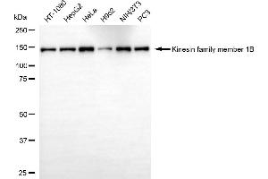 Western blotting analysis using kinesin family member 1B antibody (ABIN7799201). (KIF1B anticorps)