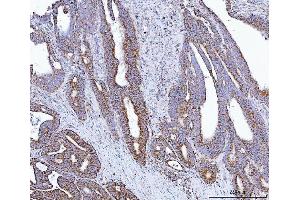 IHC analysis of GLUD1/2 using anti-GLUD1/2 antibody (ABIN7602000). (GLUD1 / GLUD2 (AA 54-553) anticorps)