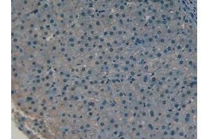Detection of CLL1 in Human Liver Tissue using Polyclonal Antibody to Collectin Liver 1 (CLL1) (COLEC10 anticorps  (AA 34-277))