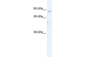 Western Blotting (WB) image for anti-Sirtuin 1 (SIRT1) antibody (ABIN2460449) (SIRT1 anticorps)