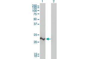 Western Blot analysis of CRADD expression in transfected 293T cell line by CRADD monoclonal antibody (M01), clone 1F8.