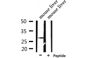 Western blot analysis of extracts from mouse liver, using PEX11A Antibody. (PEX11A anticorps  (Internal Region))