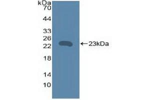 Western blot analysis of recombinant Human TNFRSF5. (CD40 anticorps  (AA 26-187))