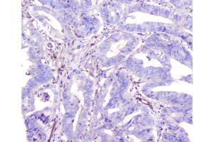 IHC analysis of ADA using anti-ADA antibody (ABIN6719272). (ADA anticorps  (AA 135-363))
