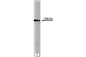Western blot analysis of Akt on HCT-8 cell lysate. (AKT1 anticorps)