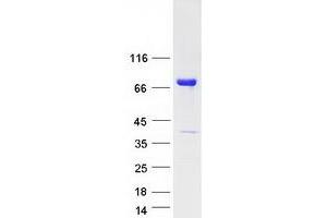 Validation with Western Blot