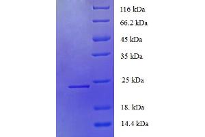 SDS-PAGE (SDS) image for Plasminogen Activator, Urokinase Receptor (PLAUR) (AA 1-178), (partial) protein (His tag) (ABIN5710115)