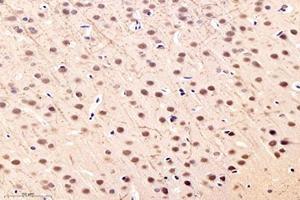 Immunohistochemistry analysis of paraffin-embedded rat hippocampus using,NOS1AP (ABIN7074844) at dilution of 1: 4000 (NOS1AP anticorps)