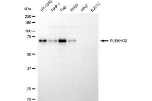 Western blotting analysis using PLEKHO2 antibody (ABIN7799852).