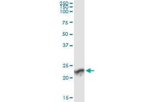 Immunoprecipitation of GUK1 transfected lysate using anti-GUK1 monoclonal antibody and Protein A Magnetic Bead , and immunoblotted with GUK1 MaxPab rabbit polyclonal antibody.