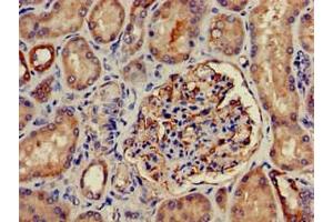 Immunohistochemistry of paraffin-embedded human kidney tissue using ABIN7169035 at dilution of 1:100 (PRKD3 anticorps  (AA 326-510))