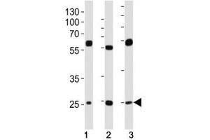 Western blot analysis of lysate from (1) HeLa, (2) HepG2 and (3) U-2OS cell line using TFAM antibody at 1:1000.