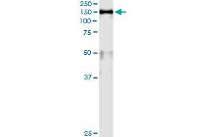 Immunoprecipitation of MCM2 transfected lysate using anti-MCM2 monoclonal antibody and Protein A Magnetic Bead , and immunoblotted with MCM2 MaxPab rabbit polyclonal antibody.
