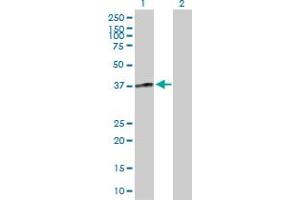 Western Blot analysis of FCGR3A expression in transfected 293T cell line by FCGR3A MaxPab polyclonal antibody.