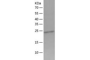 Western Blotting (WB) image for Grancalcin, EF-Hand Calcium Binding Protein (GCA) (AA 1-217) protein (His-IF2DI Tag) (ABIN7123191)