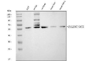 Western blot analysis of OAT2/SLC22A7 using anti-OAT2/SLC22A7 antibody (ABIN7601355).