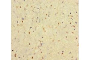 Immunohistochemistry of paraffin-embedded human smooth muscle tissue using ABIN7156578 at dilution of 1:100 (IFNAR2 anticorps  (AA 27-243))