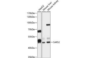 Western blot analysis of extracts of various cell lines, using S antibody (ABIN6132970, ABIN6147387, ABIN6147388 and ABIN6215904) at 1:1000 dilution.