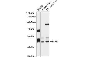 Western blot analysis of extracts of various cell lines, using S antibody (ABIN6132970, ABIN6147387, ABIN6147388 and ABIN6215904) at 1:1000 dilution. (SARS2 anticorps  (AA 289-518))