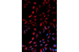 Immunofluorescence analysis of U2OS cells using CPE antibody (ABIN5973172). (CPE anticorps)