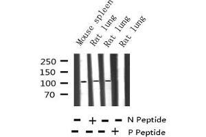 Western blot analysis of Phospho-NF kappaB p100/p52 (Ser865) expression in various lysates