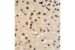 Image no. 1 for anti-FK506 Binding Protein 10, 65 KDa (FKBP10) (AA 65-94), (N-Term) antibody (ABIN453008)